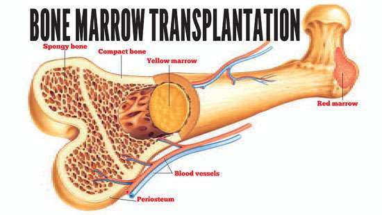 A National Bone Marrow Donor Registry: