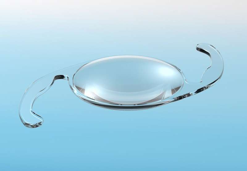 Stocks of Intraocular Lenses depleted in Sri Lanka