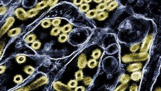 First U.S. case of human bird flu in 9 months confirmed in Washington state