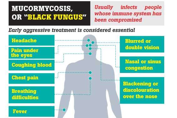 No ‘black fungus’  in Sri Lanka