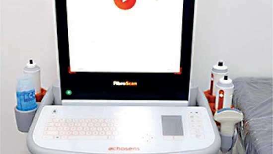 DIMO Healthcare delivers first Echosens FibroScan Expert 630 to Hemas Hospital