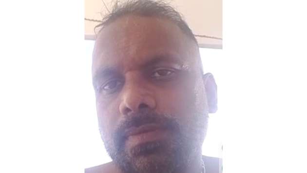 Police search suspect in Mawathagama acid attack