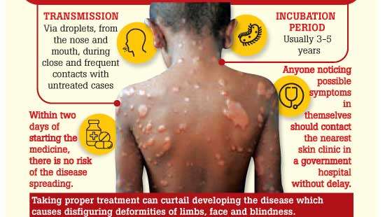 LEPROSY SPREADING AMONG CHILDREN