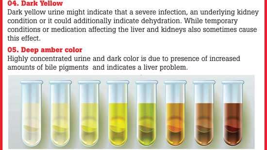 What medical conditions are associated with yellow urine? - Quora