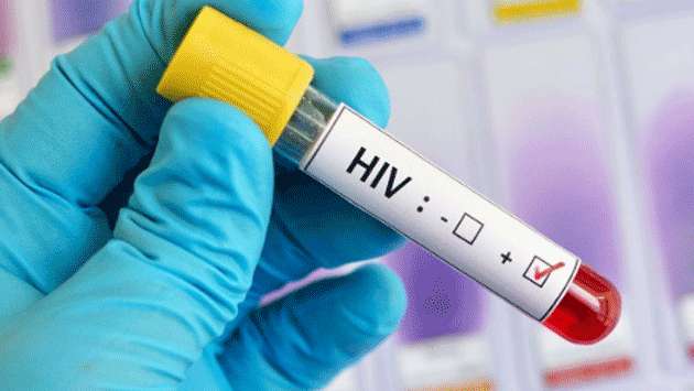 Sri Lanka records highest HIV cases in single quarter