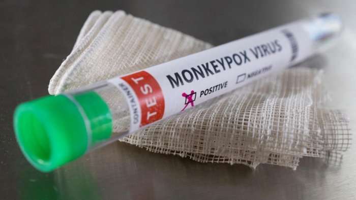 China records first monkeypox case