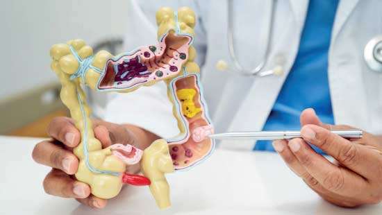 Why detecting Colorectal Cancers early can boost treatment
