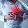 Heart disease age in Sri Lanka drops to 17: Specialist