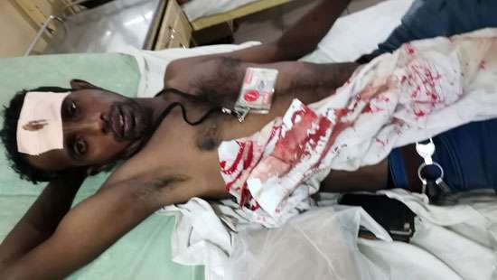 Two Daily Mirror photojournalists injured in the commotion