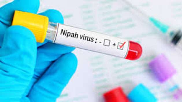 No need for unnecessary fear over Nipah virus: Health Deputy Minister