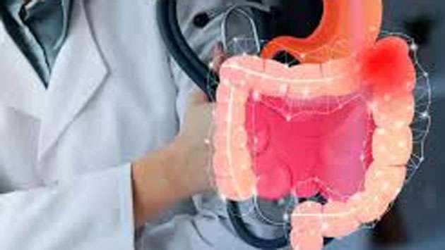 Rise in colorectal cancer among young adults raises concern