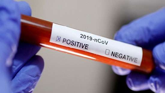 Five more test positive for COVID-19