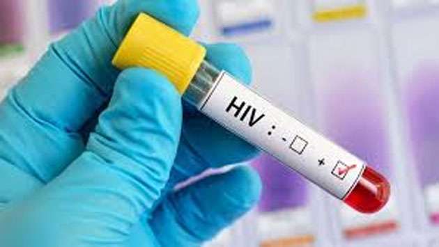 Sri Lanka HIV cases surge, despite decline in global cases