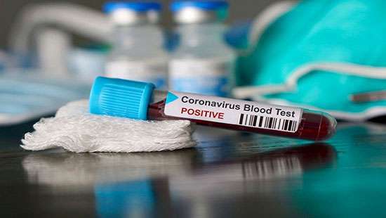 Over 600 cases reported in Colombo, Gampaha yesterday
