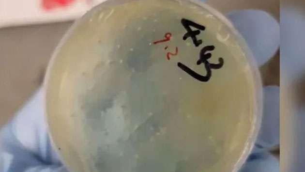 Another Chinese scientist — from Wuhan — charged with smuggling illegal biological material into US