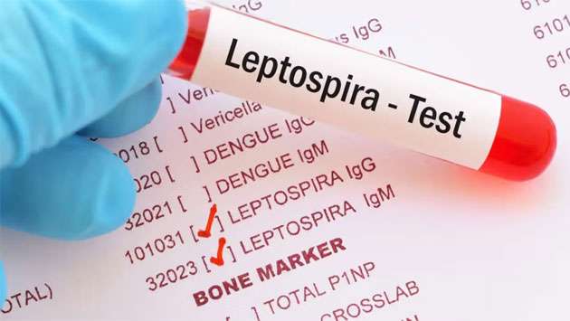 Leptospirosis cases rise in Sri Lanka