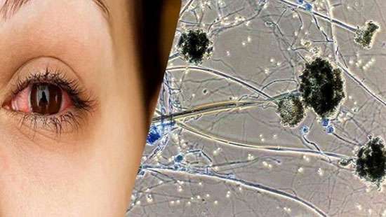 Prepare with antibiotics to face Indian black fungus infections: GMOA