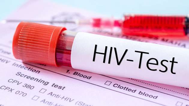 Rapid increase of HIV contracted individuals in Hambantota