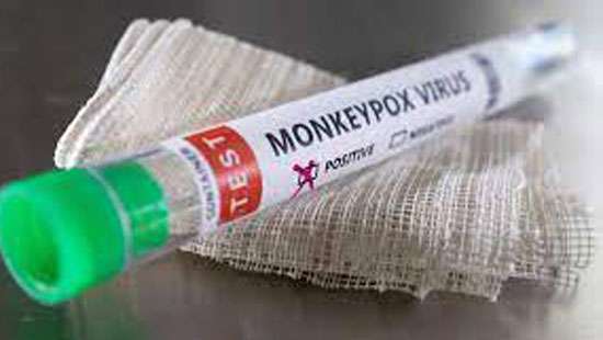 No monkey pox cases detected so far, we have facilities to check cases locally: Dr: Herath