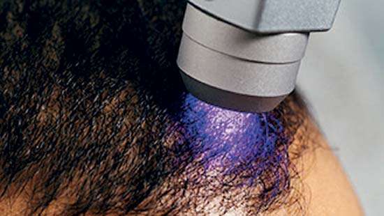 Christell Luxury Wellness unveils Sri Lanka’s first Specialty Hair Restoration Clinic