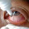 Rs. 1 mn compensation for patients who lost eyesight during Keheliya’s tenure