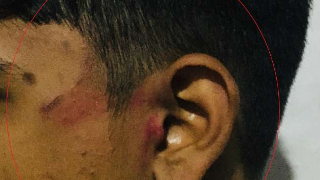 Grade 13 student hospitalised after assault by teacher