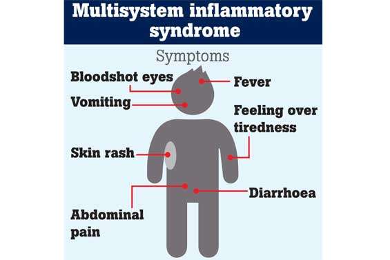 34 children reported  with Multisystem inflammatory syndrome in SL: Pediatrician