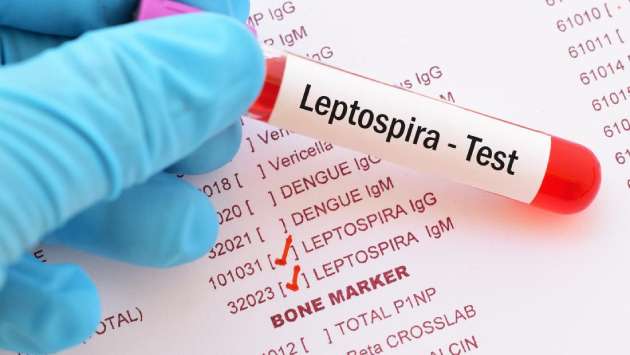 Twelve districts identified as high risk for Leptospirosis: Nalinda