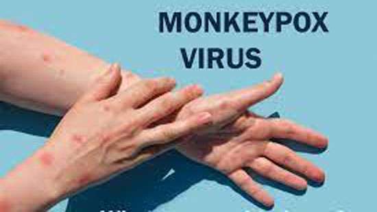 Monkeypox not proven as a sexually transmittable disease