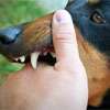70% of accident outpatient cases are animal bites: Health data