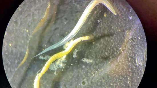 World’s longest Monkey Tapeworm found in a Lankan child in Kurunegala