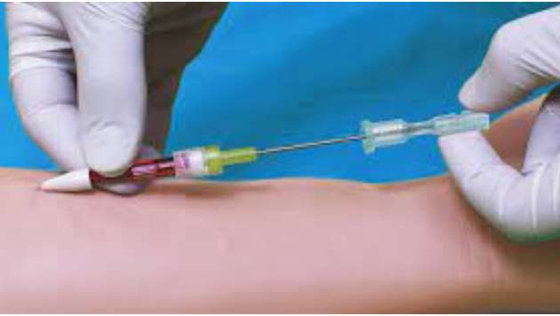 Shortage of dialysis needles pushes prices up to Rs. 760