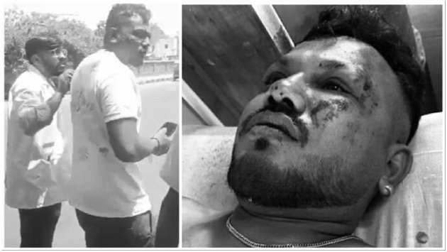Man on seat 11A miraculously walks out after deadly Air India crash