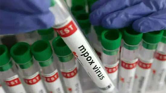 Alarm raised over outbreak of mpox in Khairpur