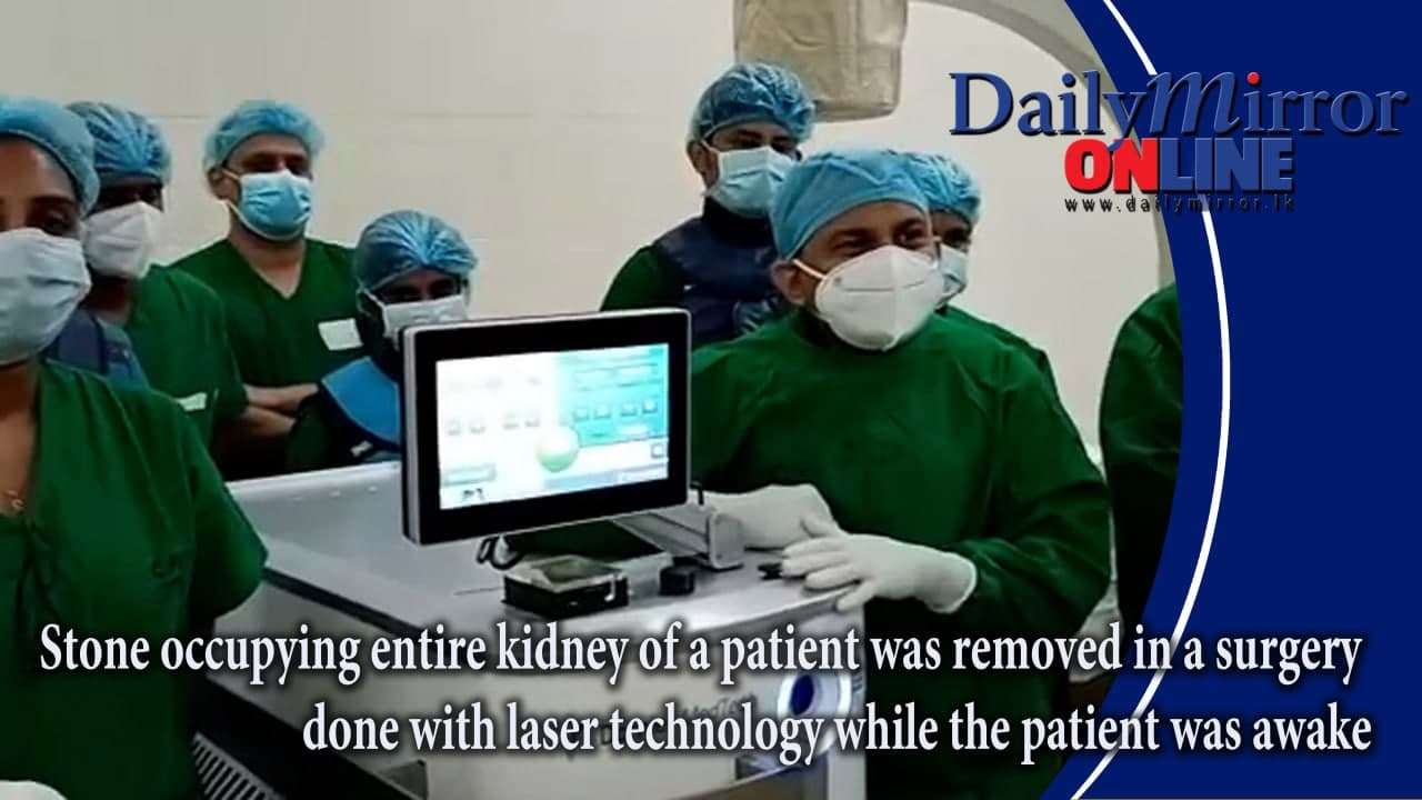 Stone occupying entire kidney of a patient was removed  in a surgery done with laser technology while the patient was awake