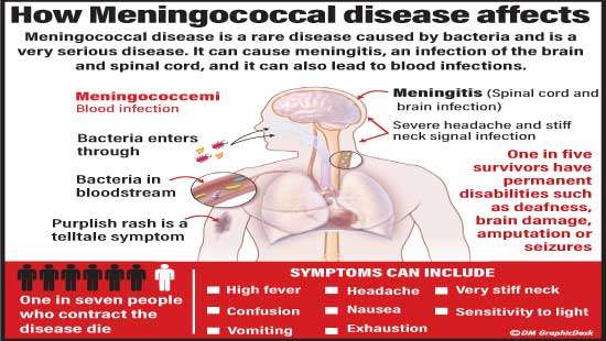 Contagious disease spreading in Galle Prison Risk of bacteria spread into society looms: Expert