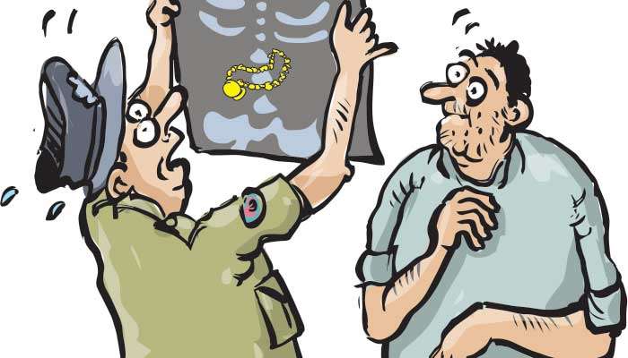 Gold necklace snatched, swallowed to avoid arrest