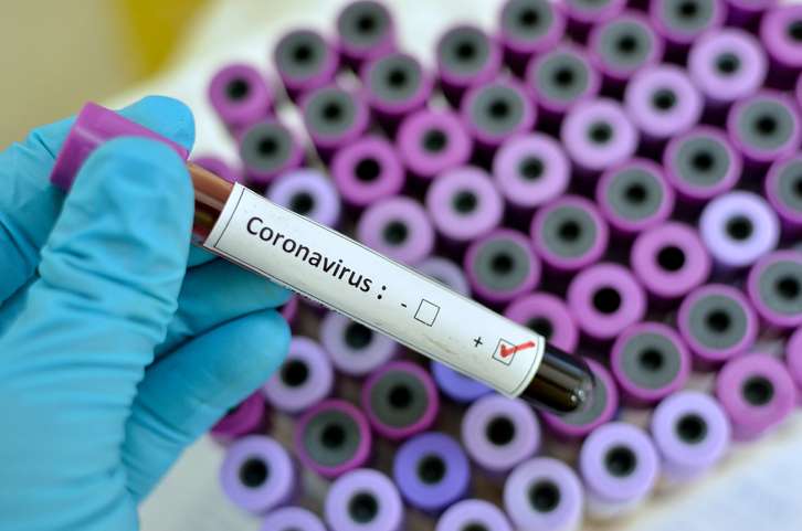 91 tested positive for COVID-19