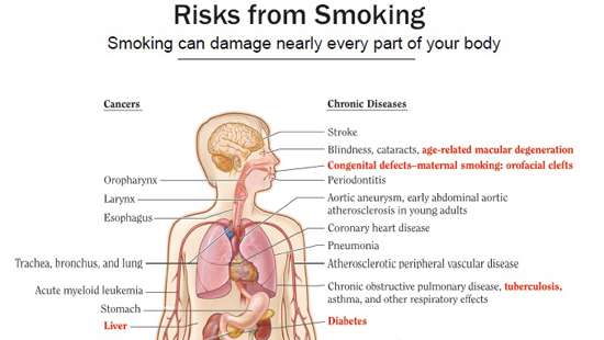 Compassionate Care at Durdans Hospital for Health Conditions Caused by Tobacco Use