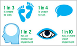 Increasing number of Cerebral Palsy patients in Sri Lanka