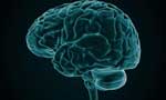 International  Day of Radiology ‘Brain Imaging’
