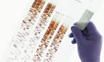 Suspect’s DNA matches with six killings in Kotakethana