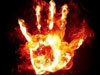 Self immolation: an Uncommon Suicidal Method in Sri Lanka
