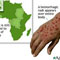 Ebola virus not a threat to SL