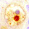New laws to contain deadly renal disease