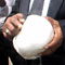 Video: ‘Specialists in a predicament how Duminda is surviving’
