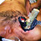 Surgeons save man’s life