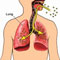 WHO findings link arsenic to kidney disease