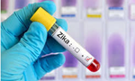 First sexually transmitted Zika virus reported in US