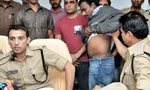 Kidney racket suspects transferred to Colombo Prison